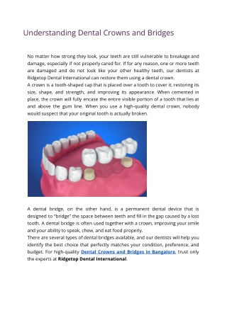 Dental Crowns and Bridges