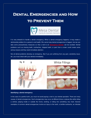Dental Emergencies and How to Prevent Them