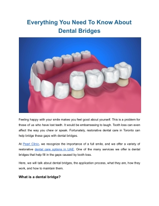 Everything You Need To Know About Dental Bridges