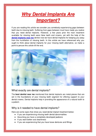 Why Dental Implants Are Important