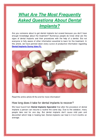 What Are The Most Frequently Asked Questions About Dental Implants