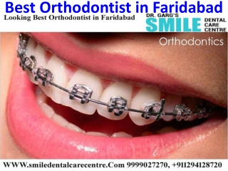 Best Orthodontist and Braces Treatment in Faridabad