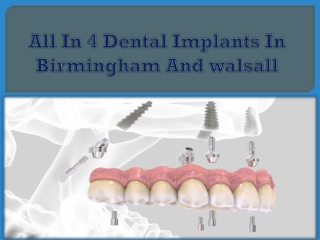 All In 4 Dental Implants In Birmingham And walsall