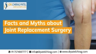 Facts and Myths About Joint Replacement Surgery