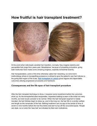 How fruitful is hair transplant treatment (1)