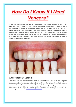 How Do I Know If I Need Veneers