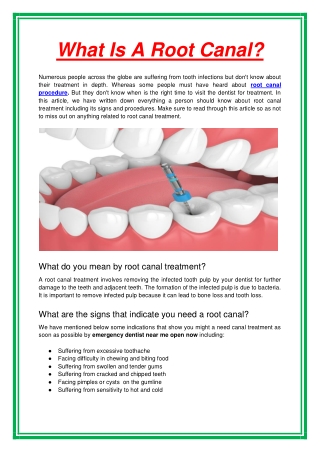 What Is A Root Canal