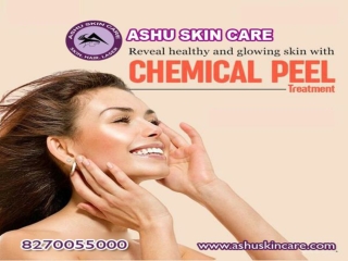 india's Best   chemical peel treatment clinic in bhubaneswar, odisha