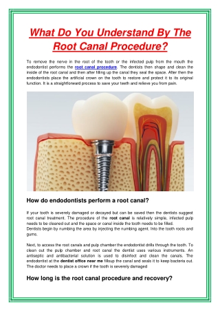 What Do You Understand By The Root Canal Procedure