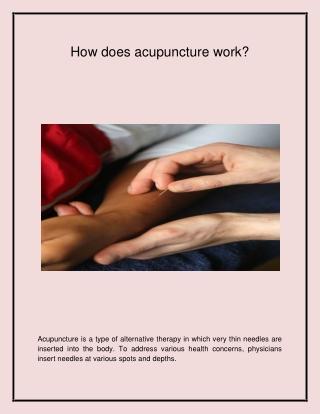 Top Acupuncture Clinic in Peckham