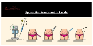 Liposuction treatment in Kerala