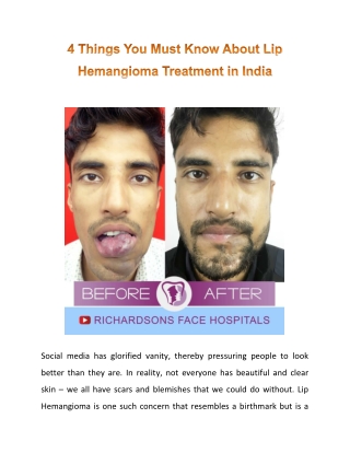 All That You Wanted To Know About Lip Hemangioma Treatment In India