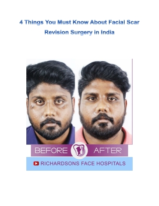 All You Need to Learn About Facial Scar Revision Surgery in India