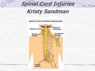 Spinal Cord Injuries Kristy Sandman
