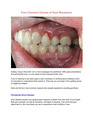 Four Common Causes of Gum Recession