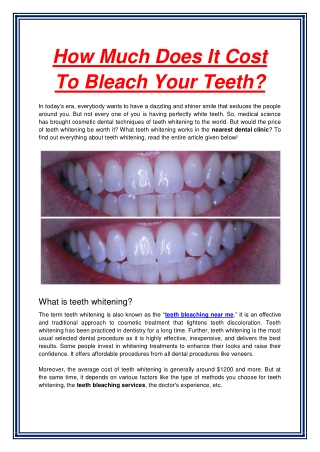 How Much Does It Cost To Bleach Your Teeth (1)