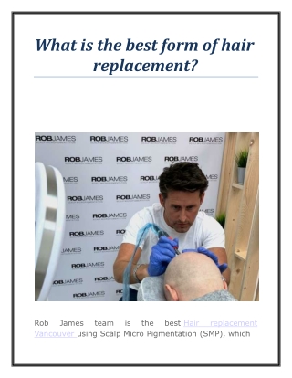 What is the best form of hair replacement