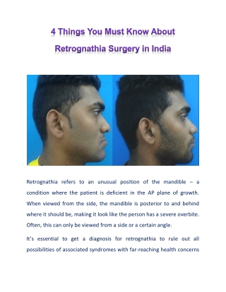All That You Wanted to Know About Retrognathia Surgery in India