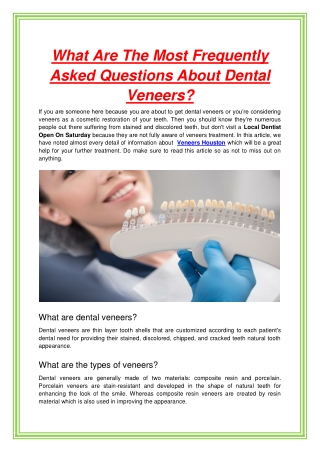 What Are The Most Frequently Asked Questions About Dental Veneers