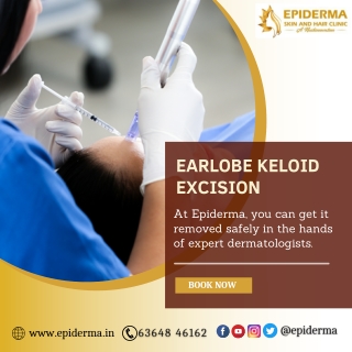 Earlobe Keloid Excision | Best Dermatology Centre in Jayanagar | Epiderma Clinic