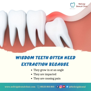 Wisdom Teeth Extraction | Best Dental Clinic in Bellandur | Nelivigi Dental