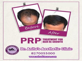 india's Best hair fall and loss treatment clinic in bhubaneswar, odisha