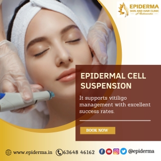 Epidermal Cell Suspension | Best Dermatologist in Jayanagar | Epiderma Clinic