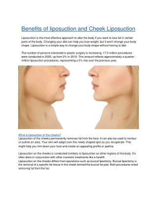 Benefits of liposuction and Cheek Liposuction