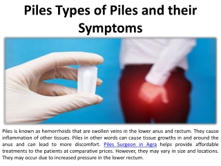 Symptoms of Pile and Their Types