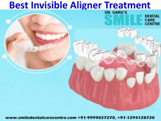 Consult Orthodontist To Get Best Invisible Aligner Treatment in India