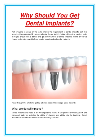 Why Should You Get Dental Implants