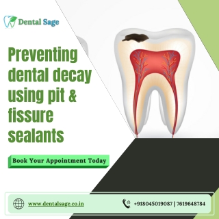 Preventing dental decay | Best Dental Clinic in Yelahanka | Dental Sage