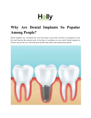 Why Are Dental Implants So Popular Among People?