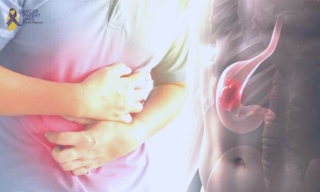 Dr Ganesh Nagarajan For Gastric Cancer Treatments