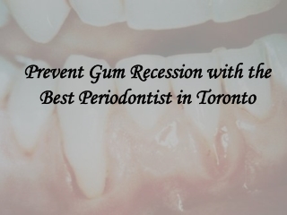 Prevent Gum Recession with the Best Periodontist in Toronto