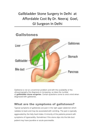 Gallbladder Stone Surgery In Delhi at Affordable Cost By Dr. Neeraj Goel, GI Surgeon In Delhi