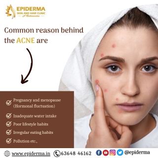 Reasons for Acne | Best Skin Clinic in Jayanagar | Epiderma Clinic