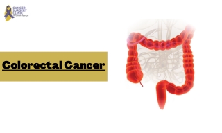 Best Cancer Hospital For Colorectal Cancer Treatment