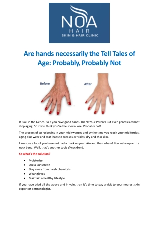 Are hands necessarily the Tell Tales of Age: Probably, Probably Not