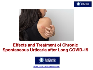Effects and Treatment of Chronic Spontaneous Urticaria after Long COVID-19
