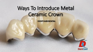 Ways To Introduce Metal Ceramic Crown