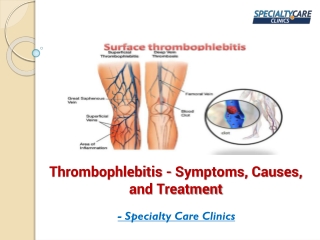 Thrombophlebitis - Symptoms, Causes, and Treatment