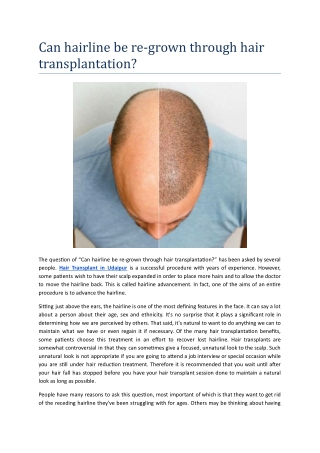 Can hairline be re-grown through hair transplantation