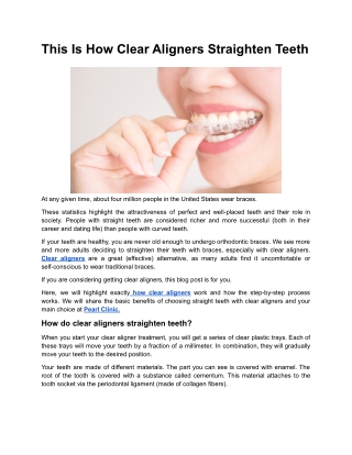 This Is How Clear Aligners Straighten Teeth