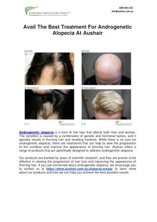 Avail The Best Treatment For Androgenetic