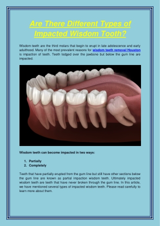 Are There Different Types of Impacted Wisdom Tooth