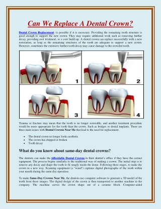 Can We Replace A Dental Crown