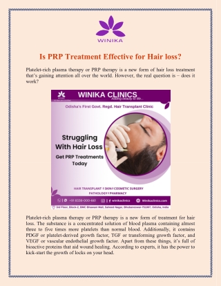 Is PRP Treatment Effective for Hair loss