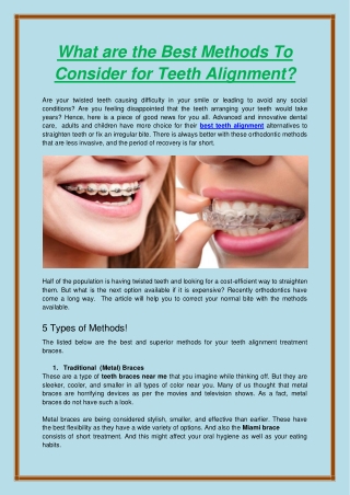 What are the Best Methods To Consider for Teeth Alignment