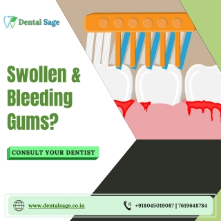 Swollen and Bleeding Gums | Best Dental Clinic in Yelahanka | Dental Sage